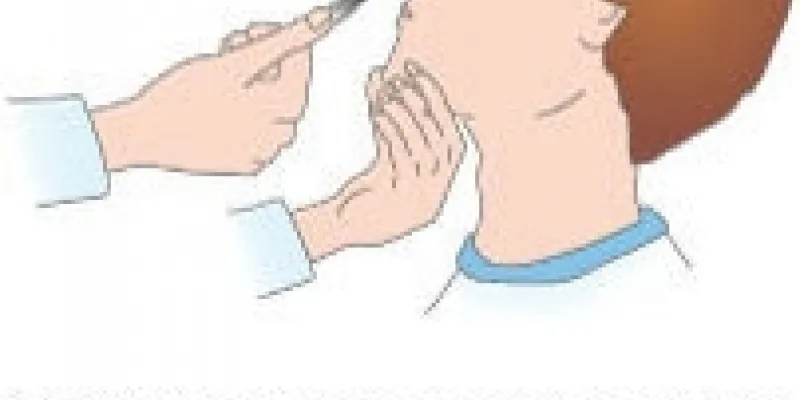 87 naesepolyp 75nm8t8qu