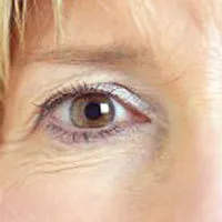 AMD stamcellebehandling