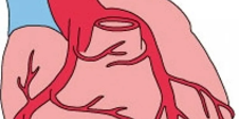 OK22a fork kranspulsaarer 1 75nm8tf86