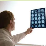 SHOT Scanning af hjerne