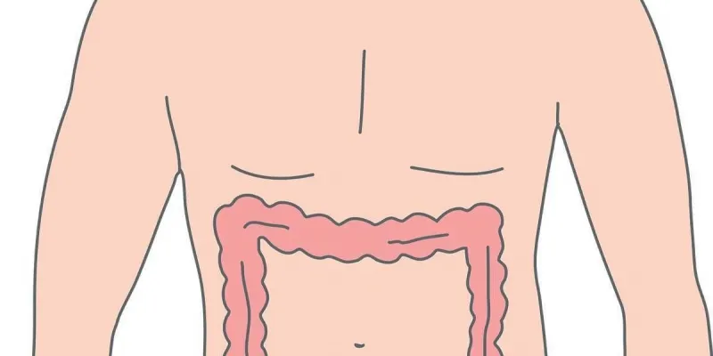 Blindtarmsbetaendelse 002949abc4 75nm8tf74