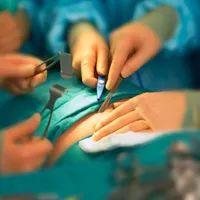 Blodprop hofteoperation