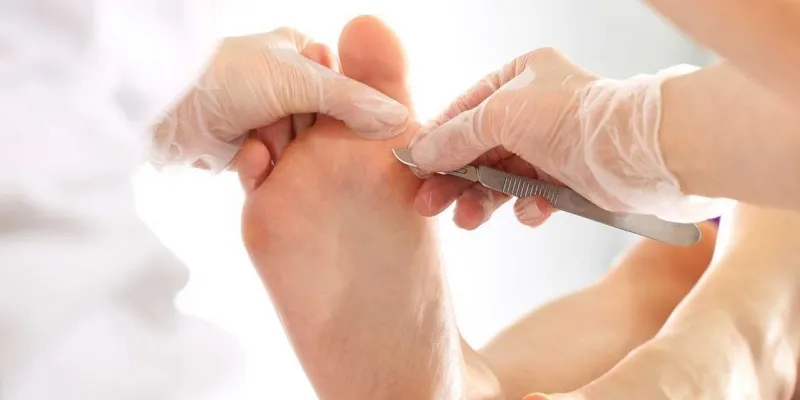 Fodterapi 3ee28e0b36 75nnxir7f