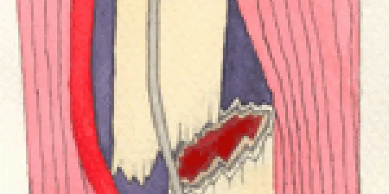 Foerstehjaelp knogler 75nm8tg5g