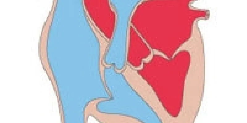 Hjertekarsygdomme hjertets opbygning 75nm8tflh