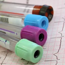 Hypercholesterolaemi