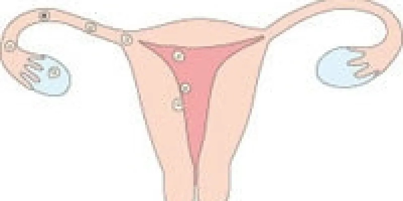 Kvinde sygdomme menstruation fertilitet 75nm8tf58