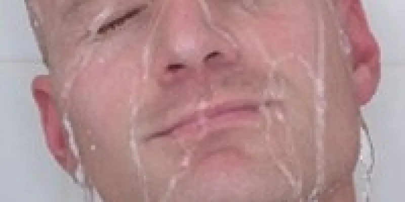 Legionella 75nm8tfvy