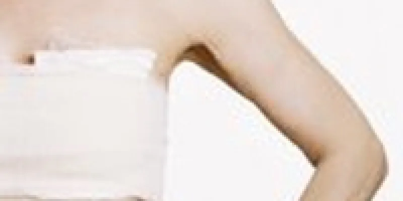 Plastikkirurgi valg implantat 75nm8tfw8