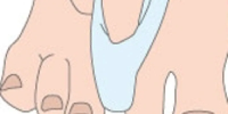 Svampeinfektioner fodsvamp 75nm8t8ps