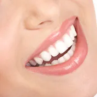 Taenderne tandeftersyn