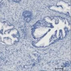 Testosteron2016540901299012