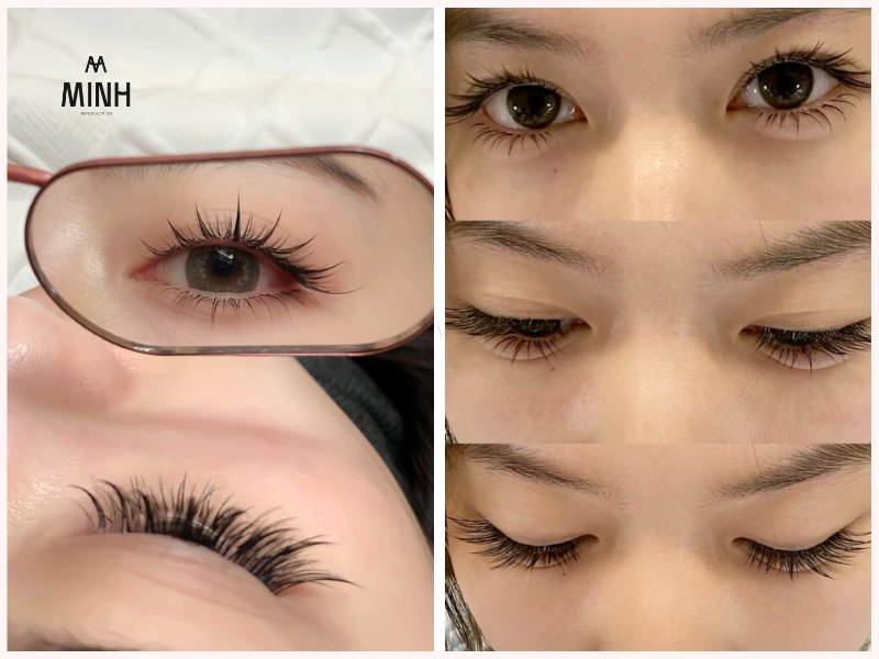 Chọn mi phù hợp còn phụ thuộc vào nhiều yếu tố