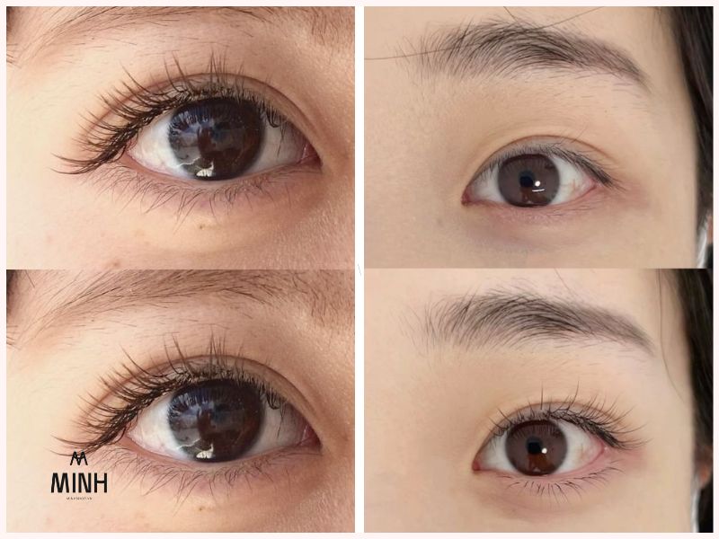 Mi nối Classic cơ bản nhưng chưa bao giờ lỗi thời