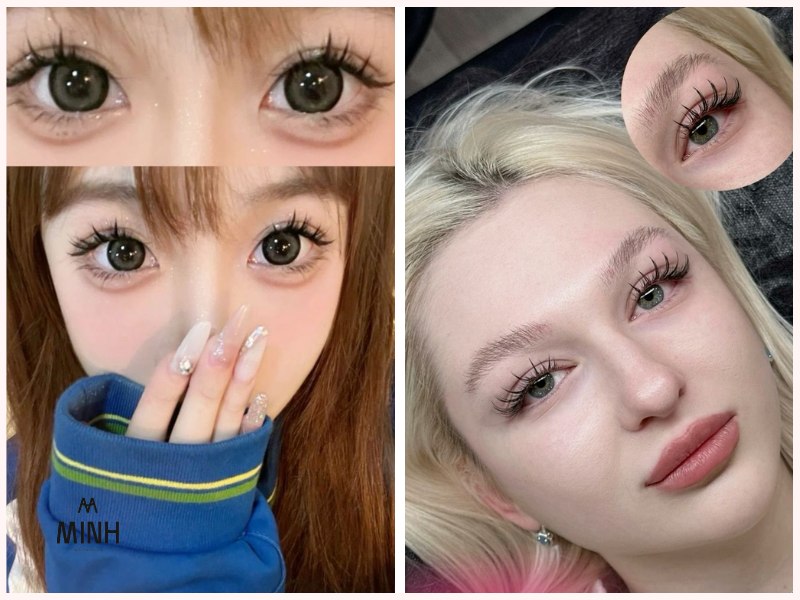 3 đến 6 tuần là thời gian giữ phổ biến của mi nối