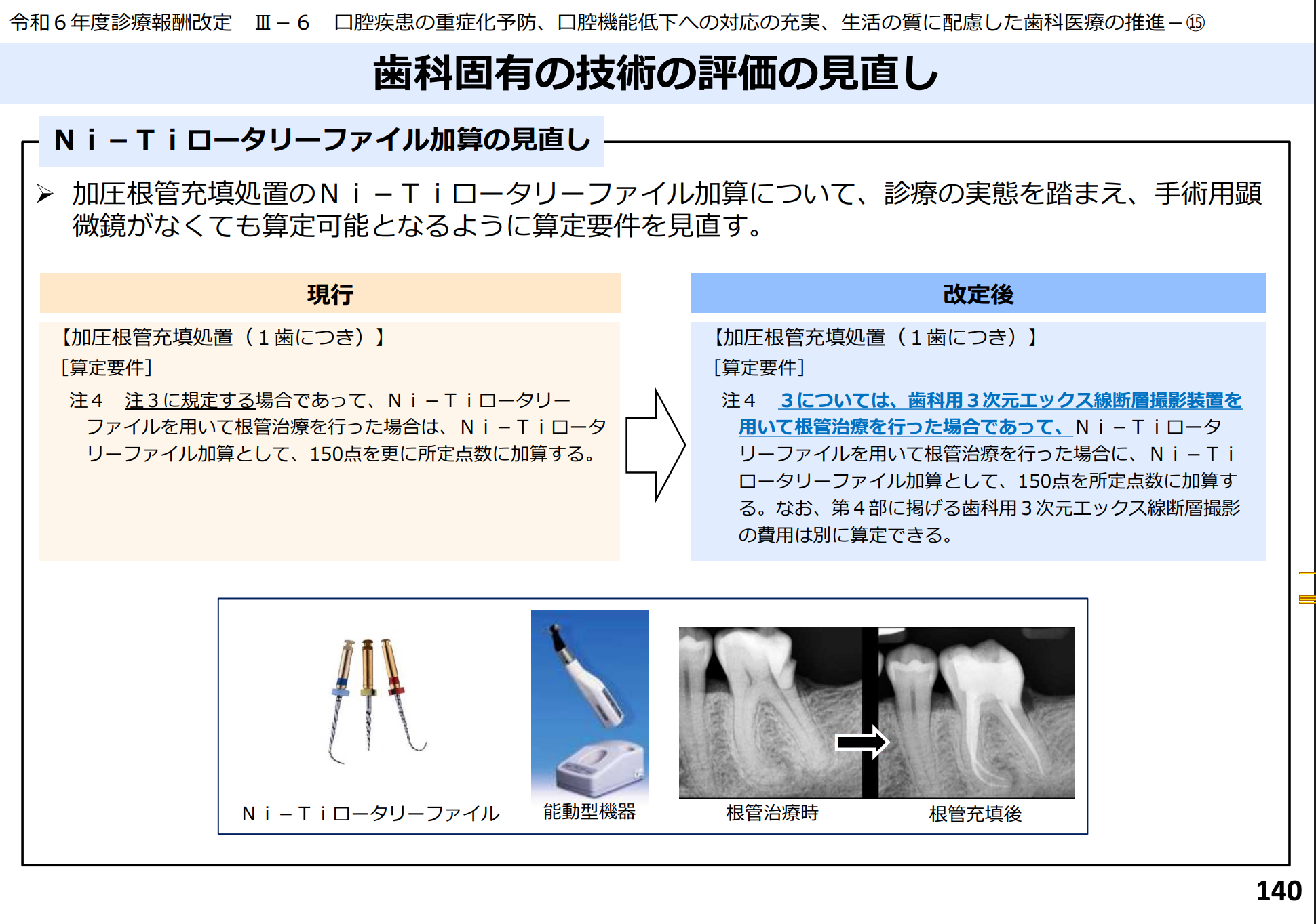 Ni-Tiロータリーファイルの加算とは？保険点数や算定要件を