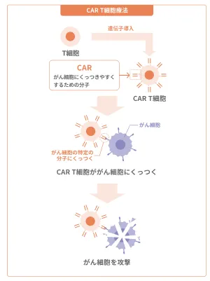 メディカルノート、悪性リンパ腫の一種“びまん性大細胞型B細胞