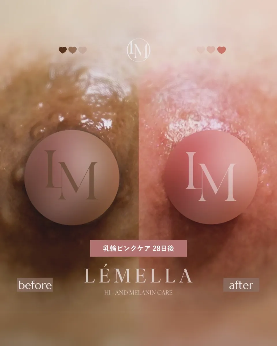 半永久！黒ずみメラニンケアLEMELLA💋