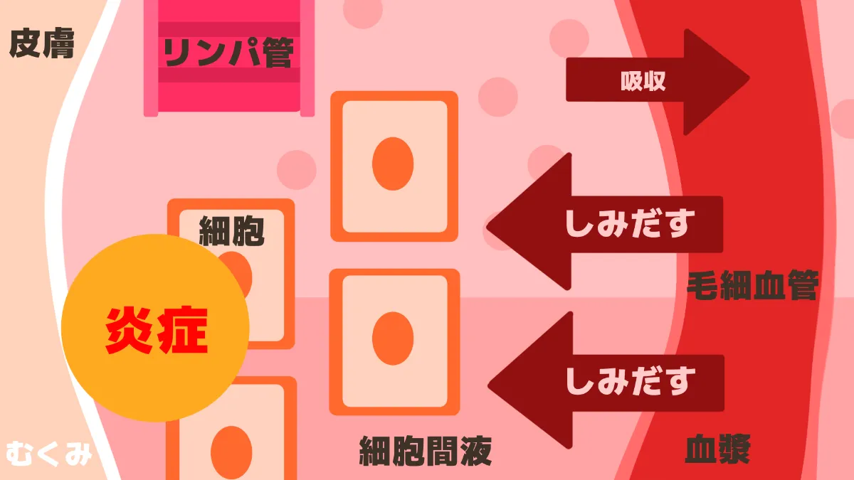 スラリ美脚への道！】むくみ解消で憧れの足へ【浮腫みメカニズム解説 
