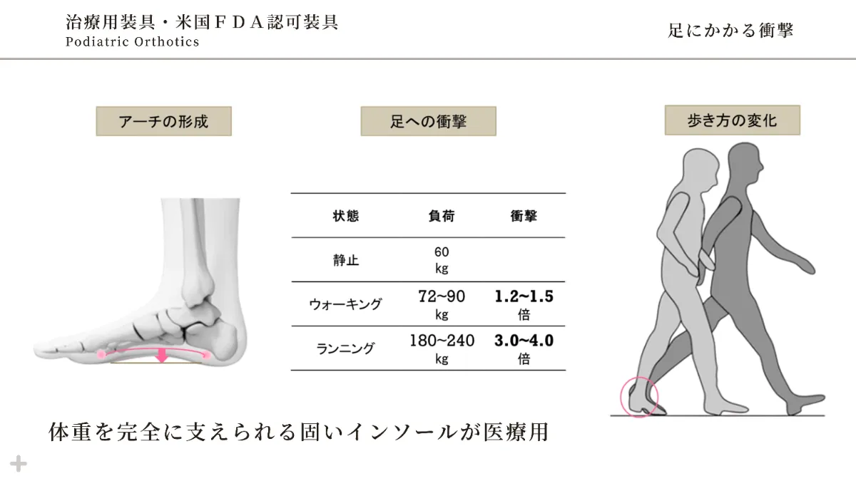 装具療法・インソール治療について ｜足と歩行のクリニック rege 