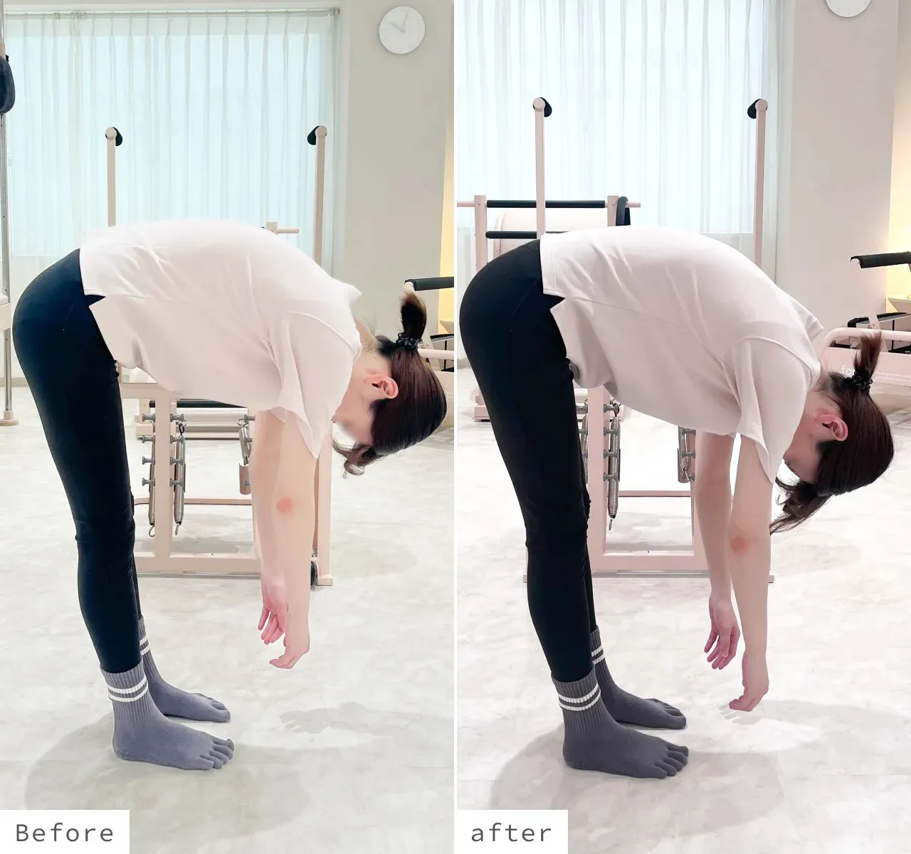 のビフォーアフター写真