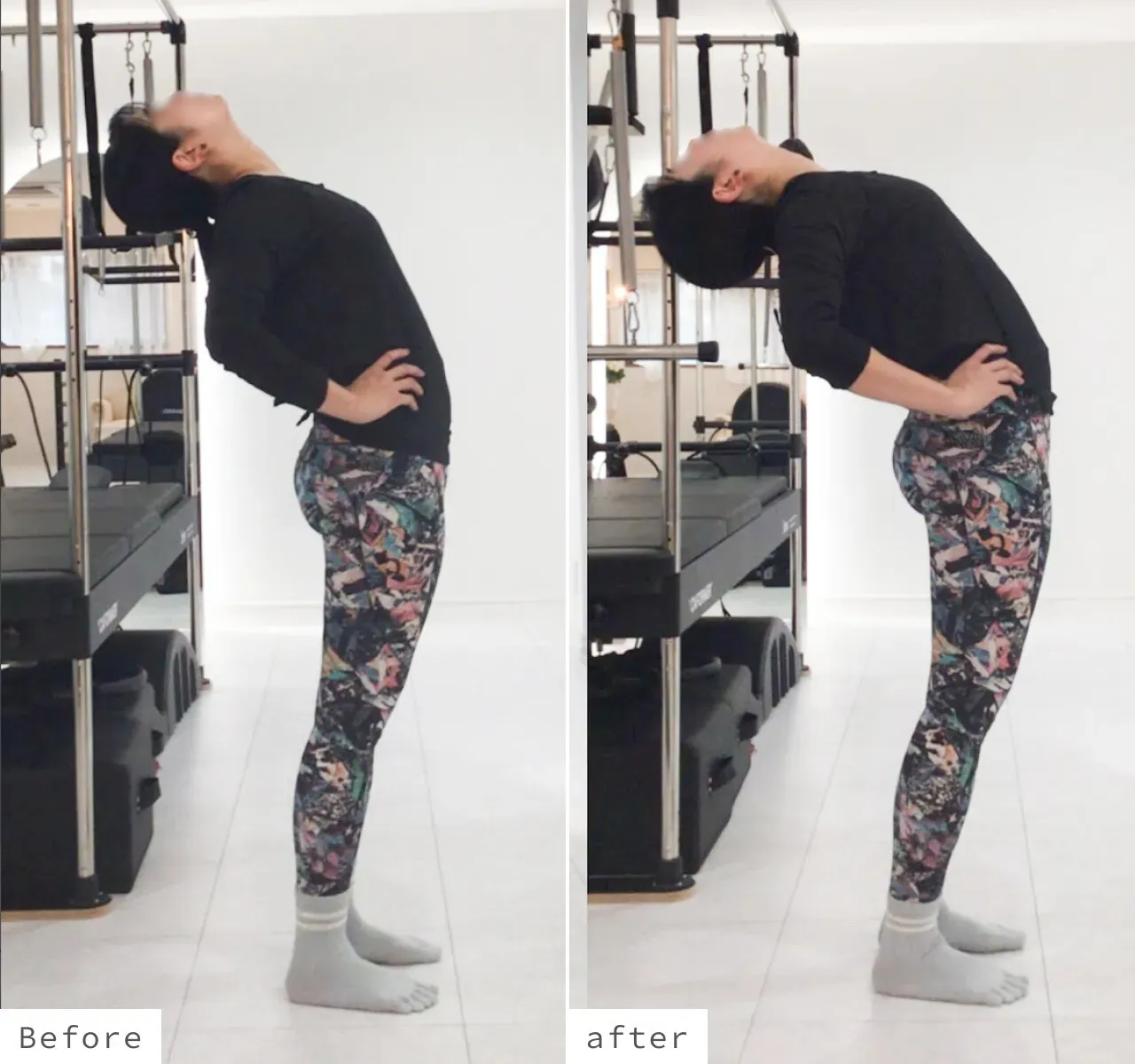 のビフォーアフター写真