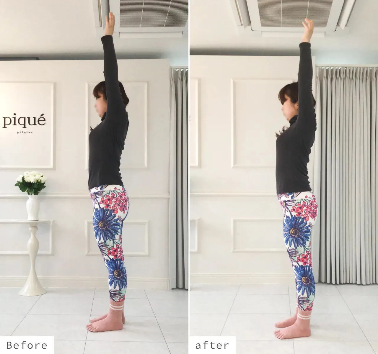 のビフォーアフター写真