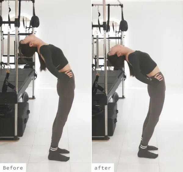 のビフォーアフター写真