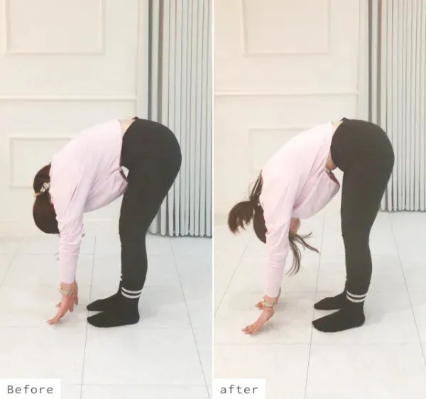 のビフォーアフター写真