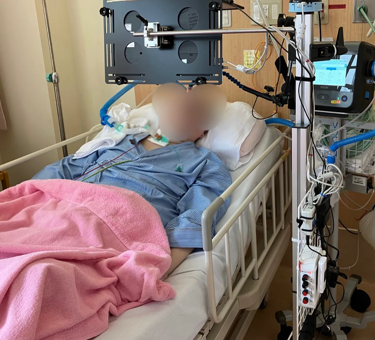 重度障害者用意思伝達装置『伝の心』の導入