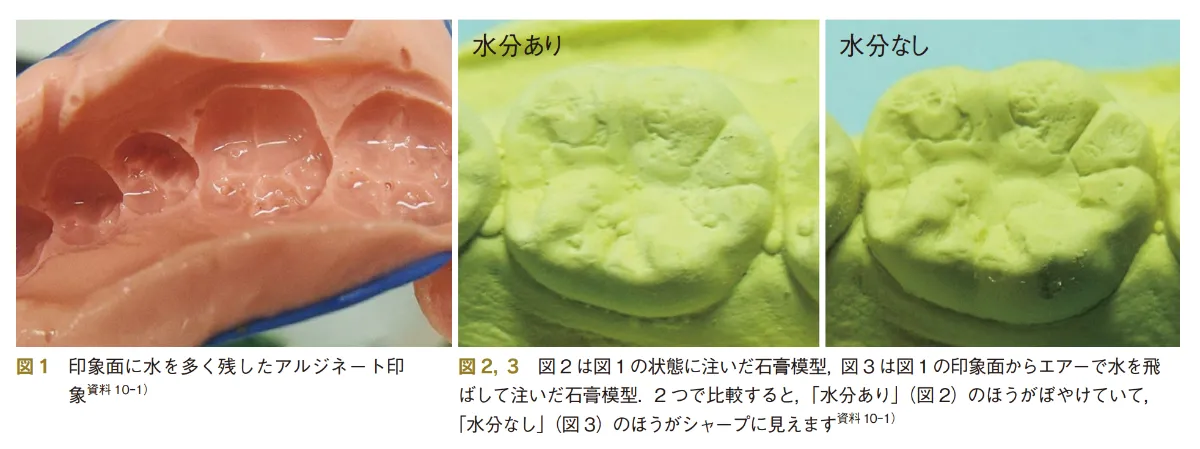 CAD/CAM冠製作の流れ：印象〜完成まで ｜エミウム クラウド技工