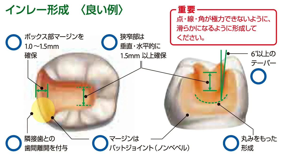 エミウム 技工センター - 最短翌日納品・適正価格のデジタル歯科技工