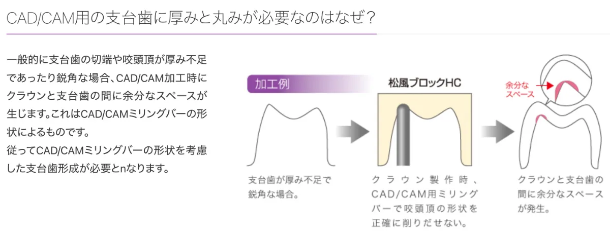 CAD/CAMインレー形成の勘どころ