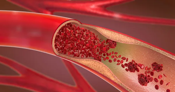 血圧:基準値は本当に正しいのか? 高血圧と低血圧の意外な真実