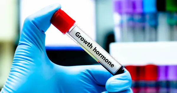 BFRトレーニングと成長ホルモンの関係──科学的根拠と効果