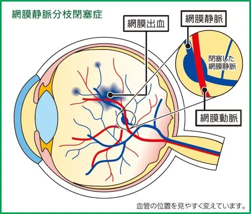 診療案内｜津田眼科｜川崎市麻生区千代ヶ丘（新百合ヶ丘）の眼科