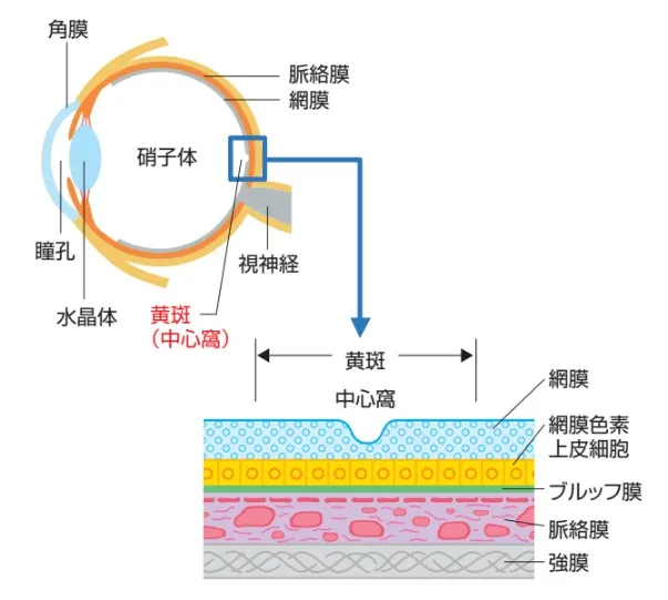 専門医のための眼科診療クオリファイ 4 加齢黄斑変性　新品未使用 眼科診療クオリファイ 4 加齢黄斑変性 ほぼ未使用