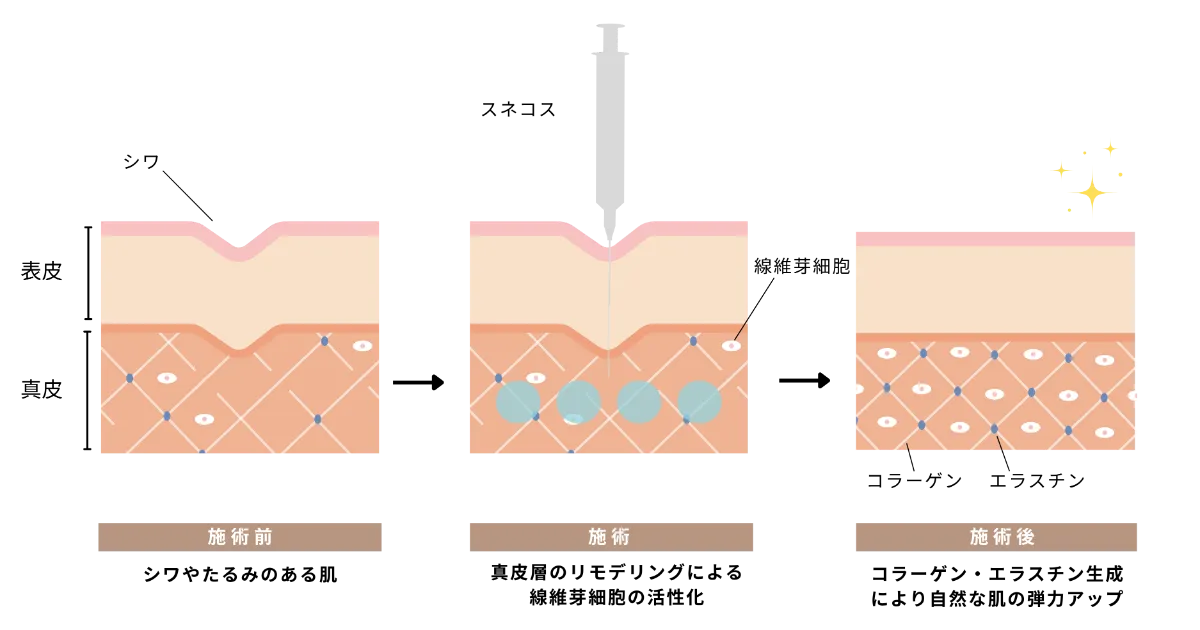 セレクト美容塾・眼瞼 セレクト美容塾・眼瞼 改訂第2版 | 克誠堂出版