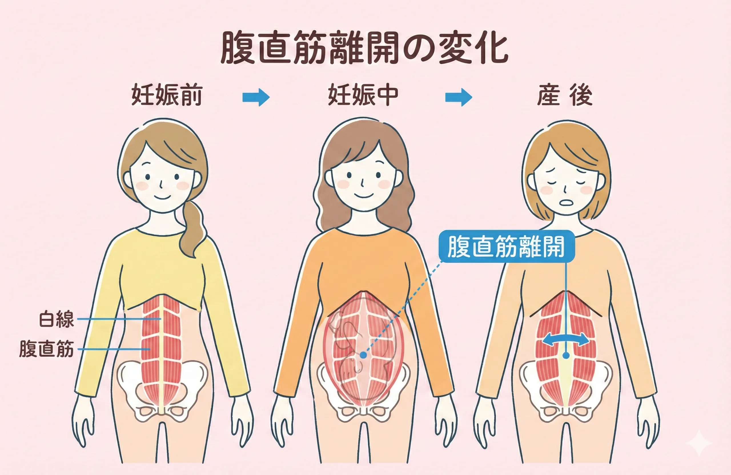 産後の腹筋の変化