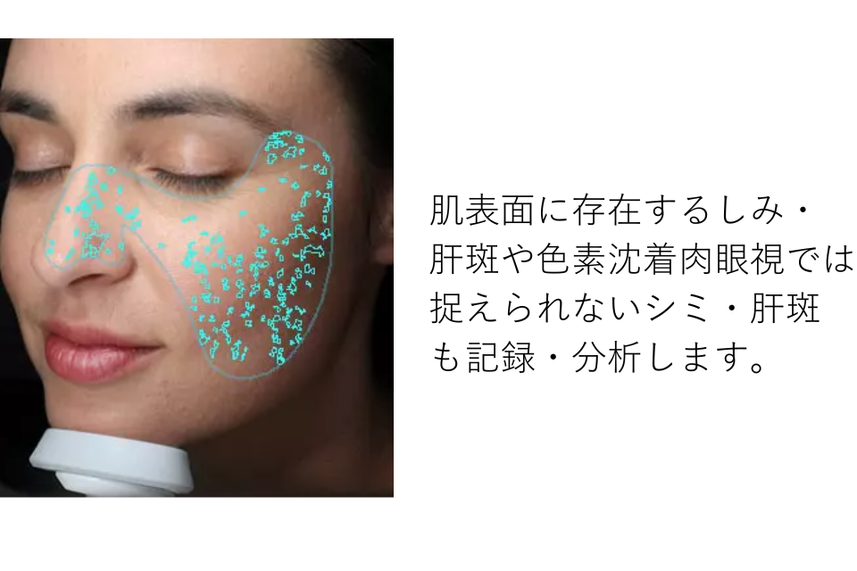 高性能肌診断機『VISIA』 ｜ReNクリニック桂 ｜ReNクリニック桂