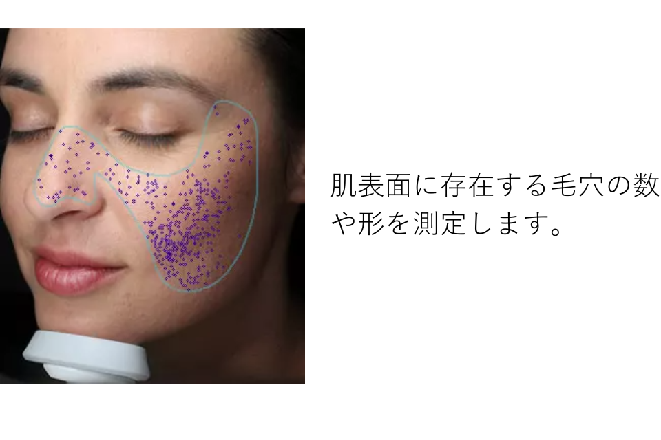 高性能肌診断機『VISIA』 ｜ReNクリニック桂 ｜ReNクリニック桂