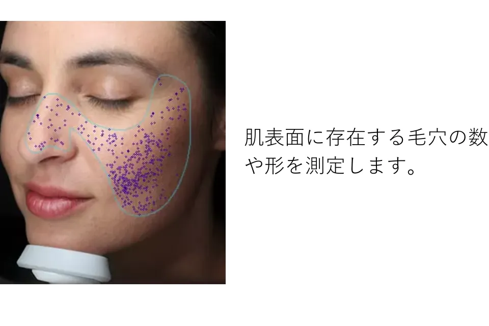 s-960x640_v-fs_webp_8abccf2e-