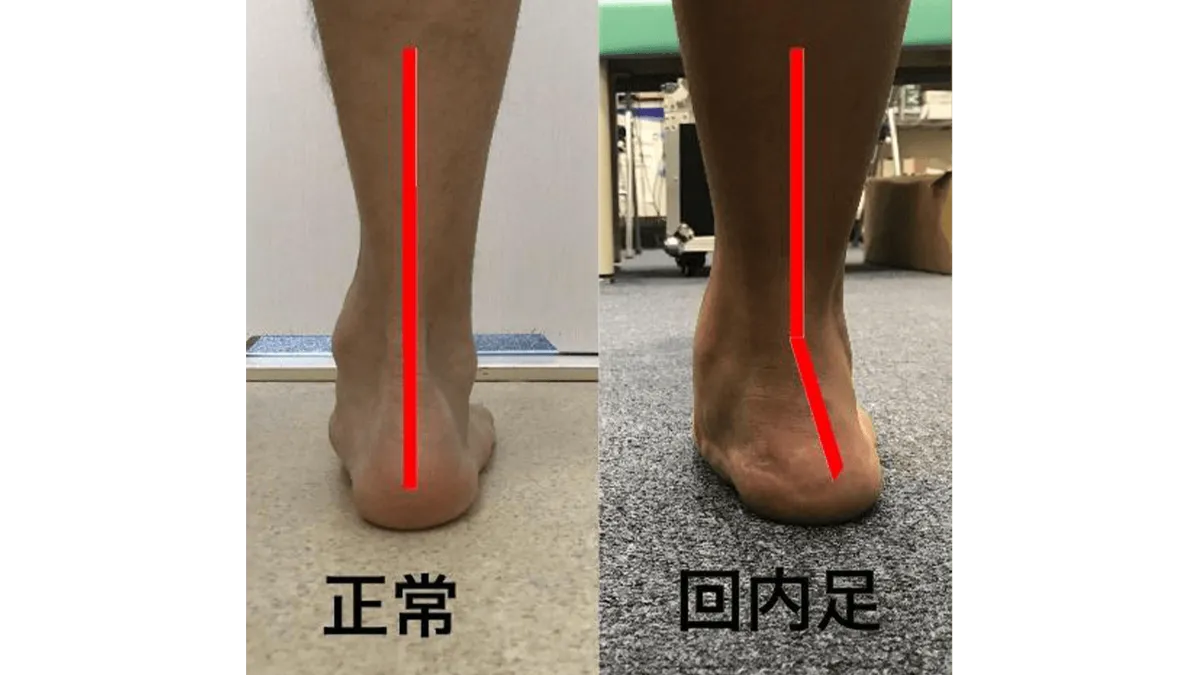 ランナー必見 腸脛靭帯炎から解放される原因別 腸脛靭帯炎解消 マニュアル Orphe Journal