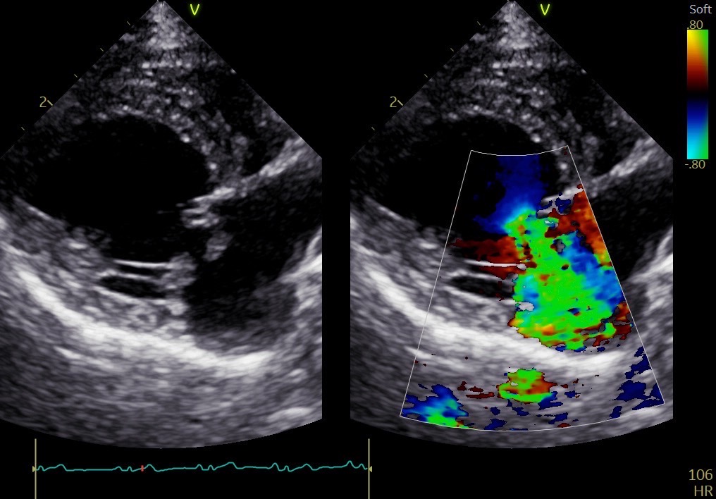 僧帽弁閉鎖不全症 | 症例紹介 | ガーデン動物病院