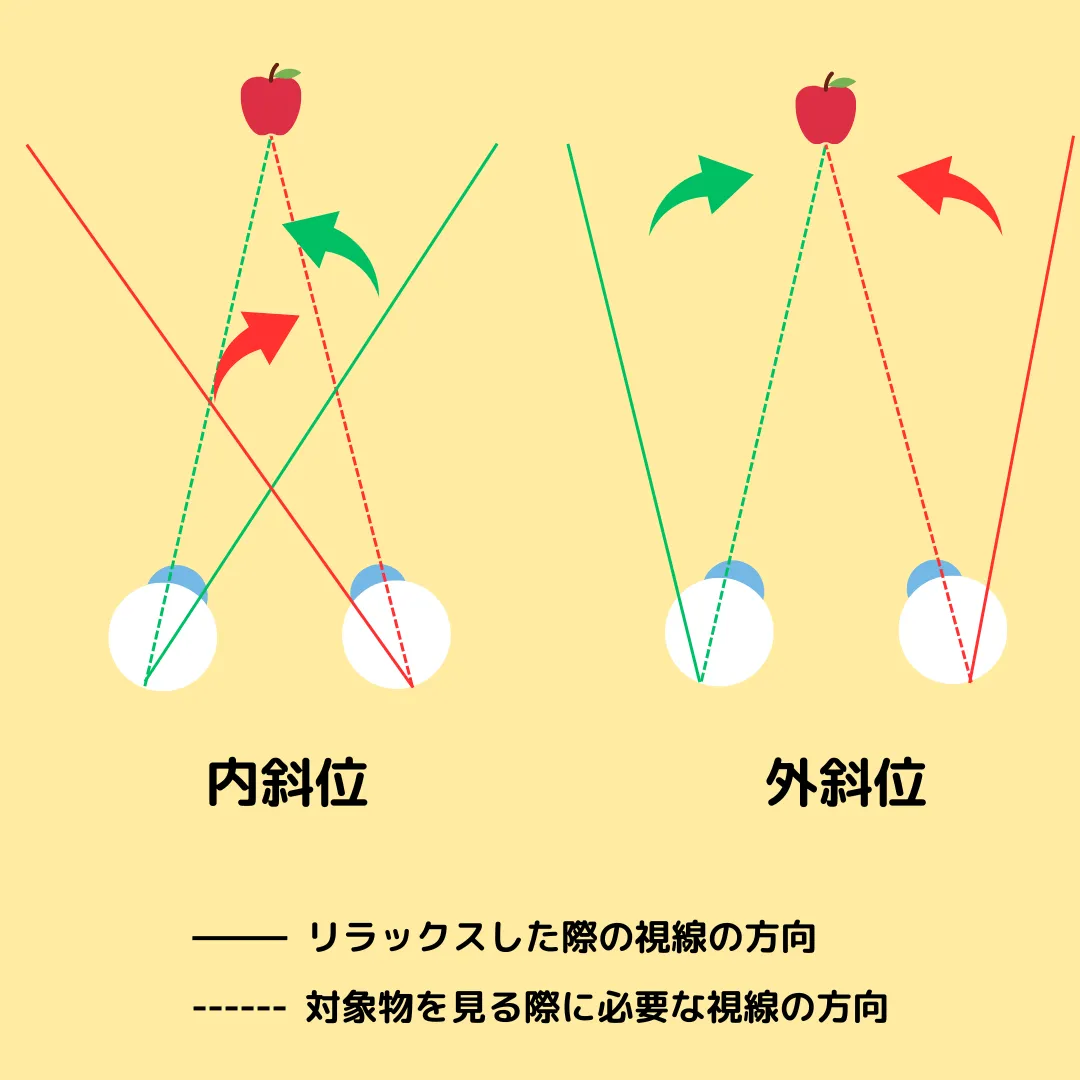 斜位の説明