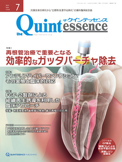 ザ・クインテッセンス7月号」掲載のお知らせ | IDSM