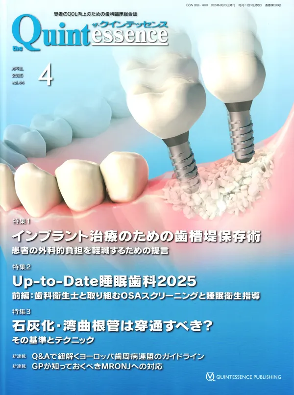 ザ・クインテッセンス4月号」掲載のお知らせ | IDSM ザ・クインテッセンス4月号」掲載のお知らせ | IDSM