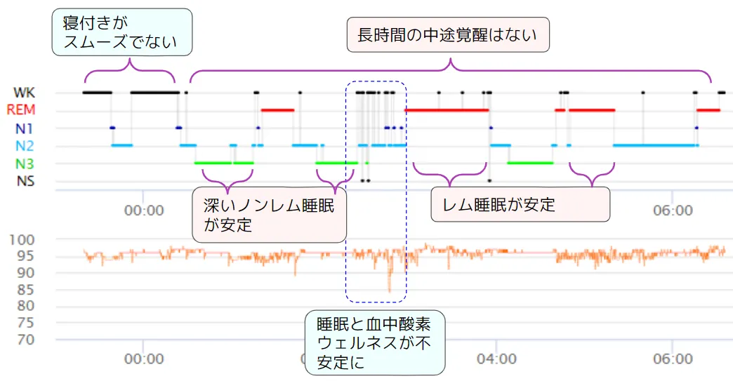 睡眠ページ 睡眠グラフを読む 〜脳波計測なら睡眠の質がここまで分かる