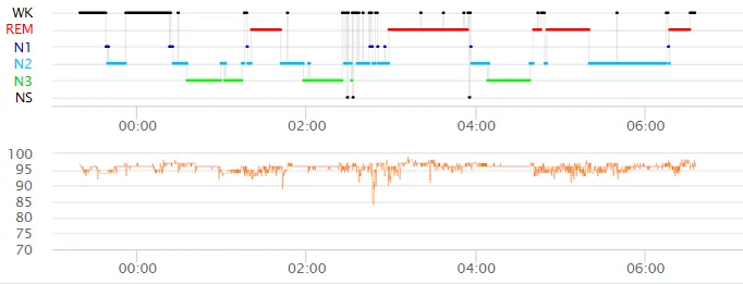 睡眠様ご確認用ページ 睡眠グラフを読む 〜脳波計測なら睡眠の質がここまで分かる
