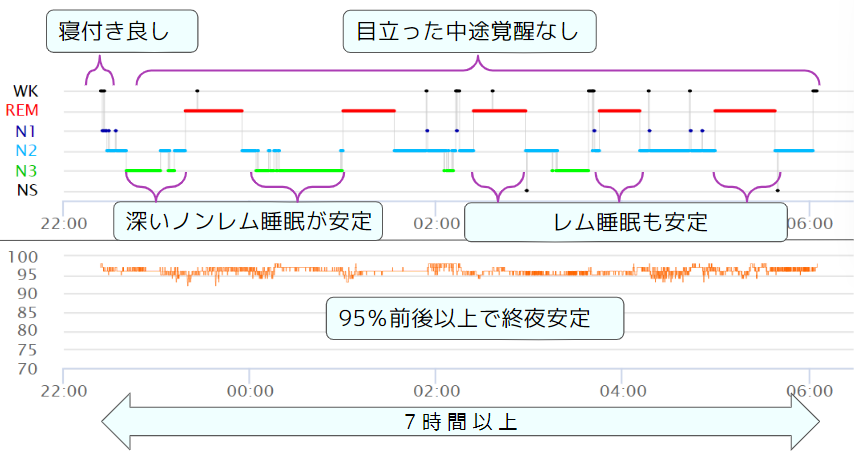 睡眠グラフを読む 〜脳波計測なら睡眠の質がここまで分かる！ ～ ｜S 